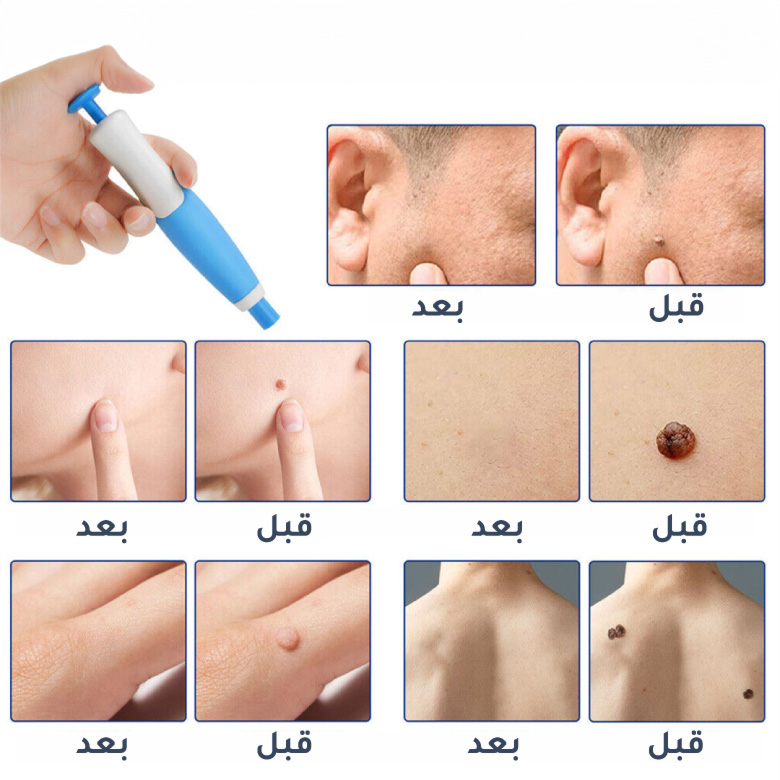 ماين-2